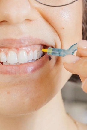 ����������� ����� � �������� ��������: ���� � ����������