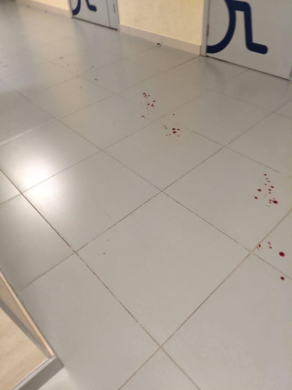 14-летний подросток с ножом ворвался в лицей и напал на охранницу 14-летний подросток с ножом ворвался в лицей и напал на охранницу