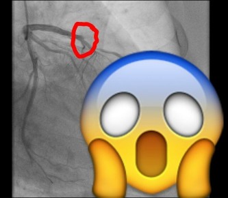 Балаковец чуть не умер по время уборки снега