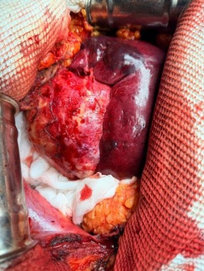 � �������� �� ������ ������� ������� 10-������������� ����� � ����������