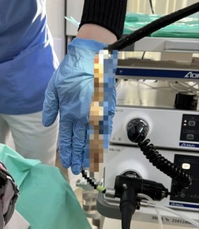 ����������� ������ ������� �������, ������������� ����� ���� � ����