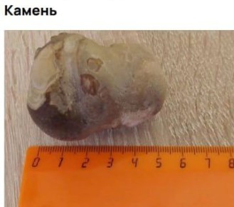 ������� : ��� �������� ������������ ���������� ����� � ��������