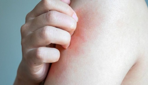 ����� ������ ��� ������������� � ��������� ���������: 4 �������, � ������� ����� �����