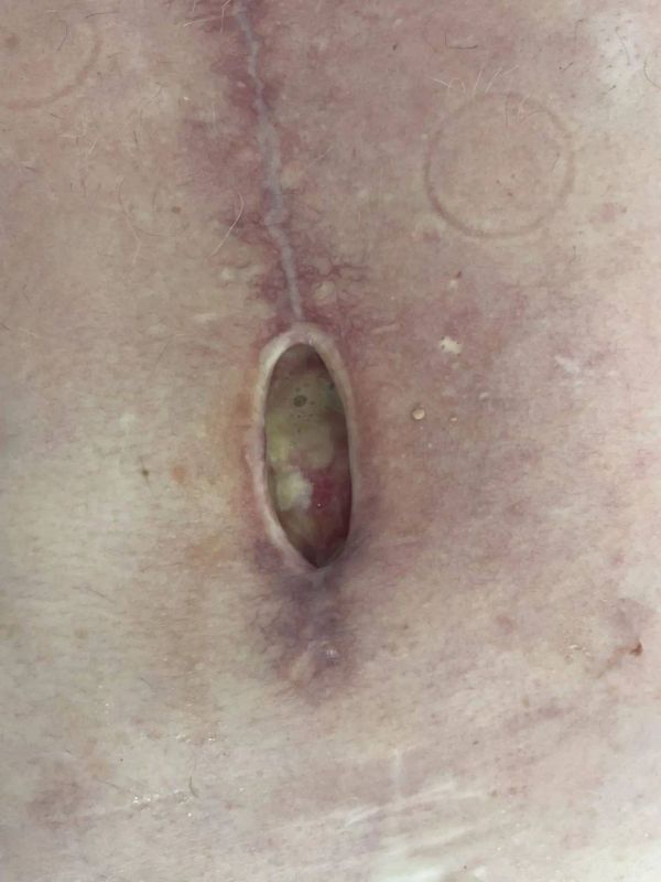 ����� �� �������� ������� �������� ������� ���� �������� � ������� VAC-�������